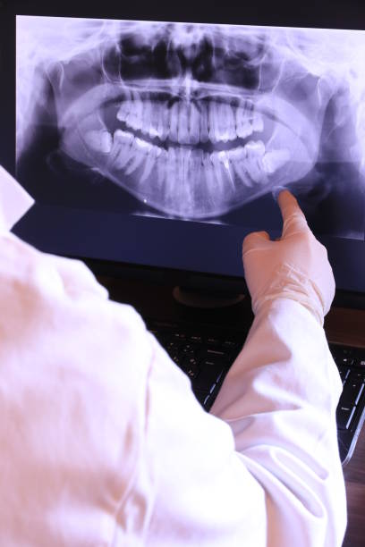Best Emergency Dental Care for Sports Injuries in Hebron, IL