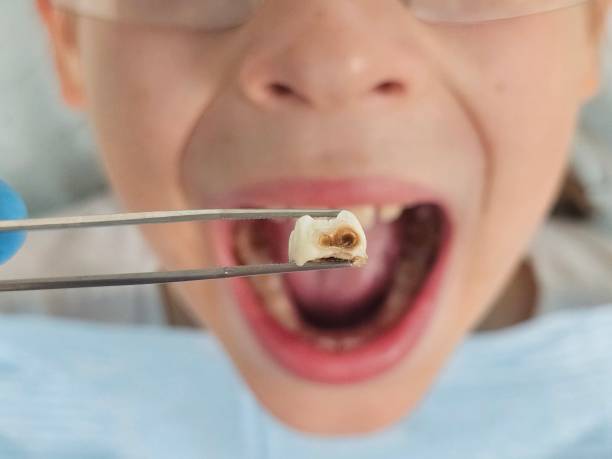 Best Emergency Treatment for Jaw Pain or Injury in Hebron, IL